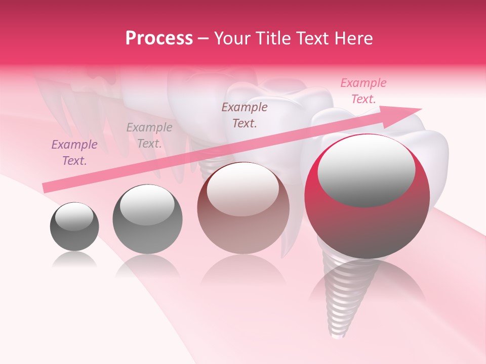 Treatment Prosthesis Isolated PowerPoint Template
