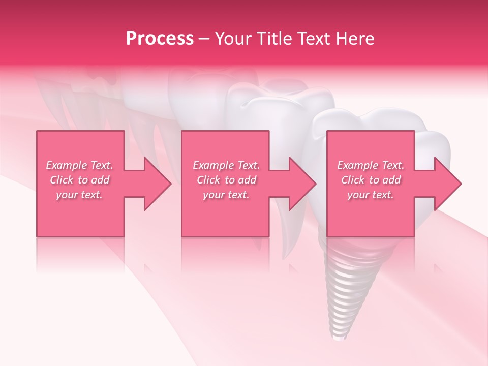 Treatment Prosthesis Isolated PowerPoint Template
