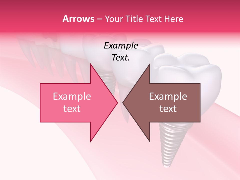 Treatment Prosthesis Isolated PowerPoint Template