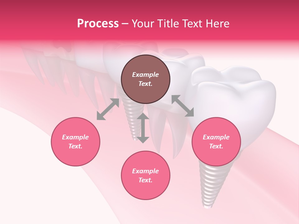 Treatment Prosthesis Isolated PowerPoint Template