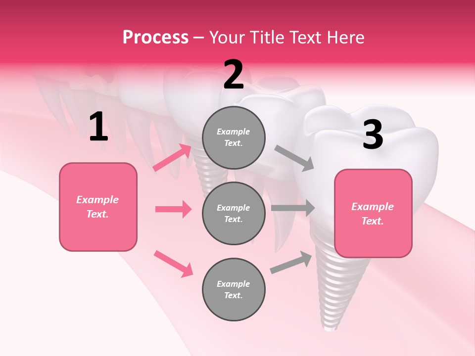 Treatment Prosthesis Isolated PowerPoint Template