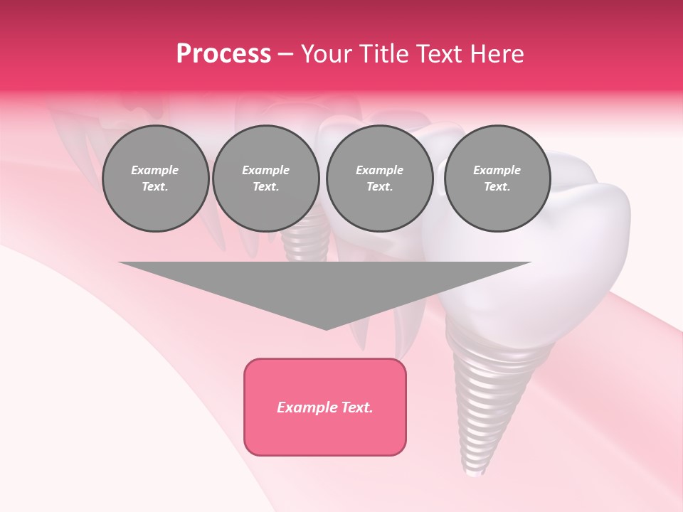 Treatment Prosthesis Isolated PowerPoint Template