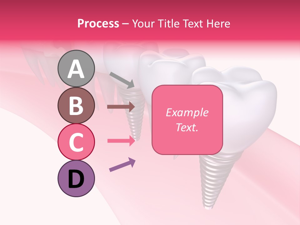 Treatment Prosthesis Isolated PowerPoint Template