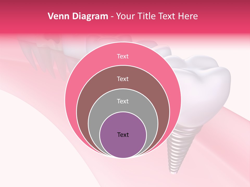 Treatment Prosthesis Isolated PowerPoint Template