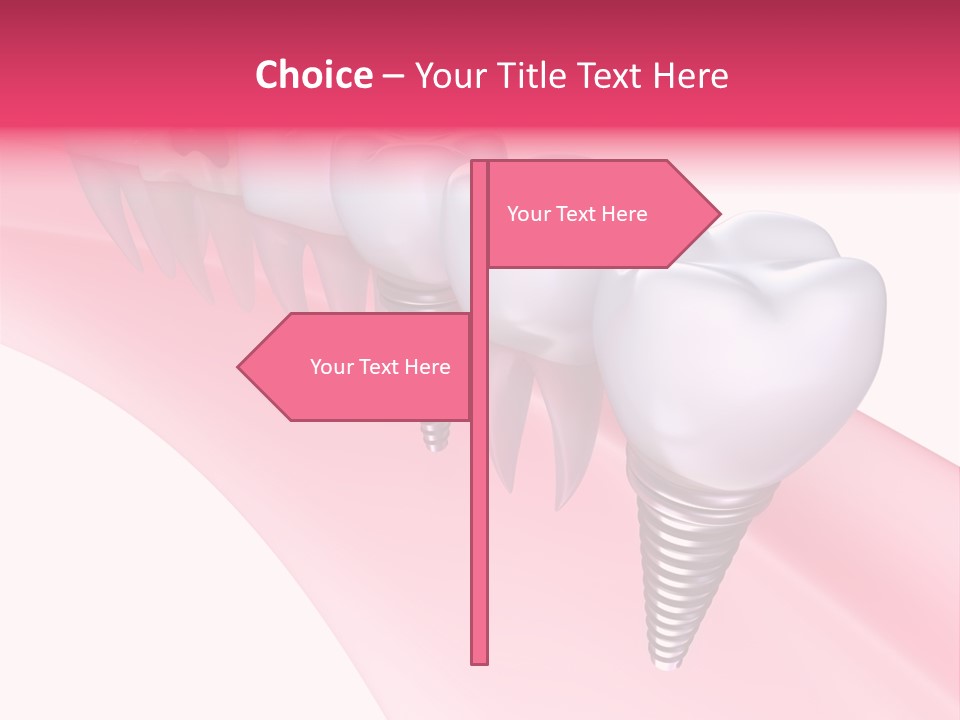 Treatment Prosthesis Isolated PowerPoint Template