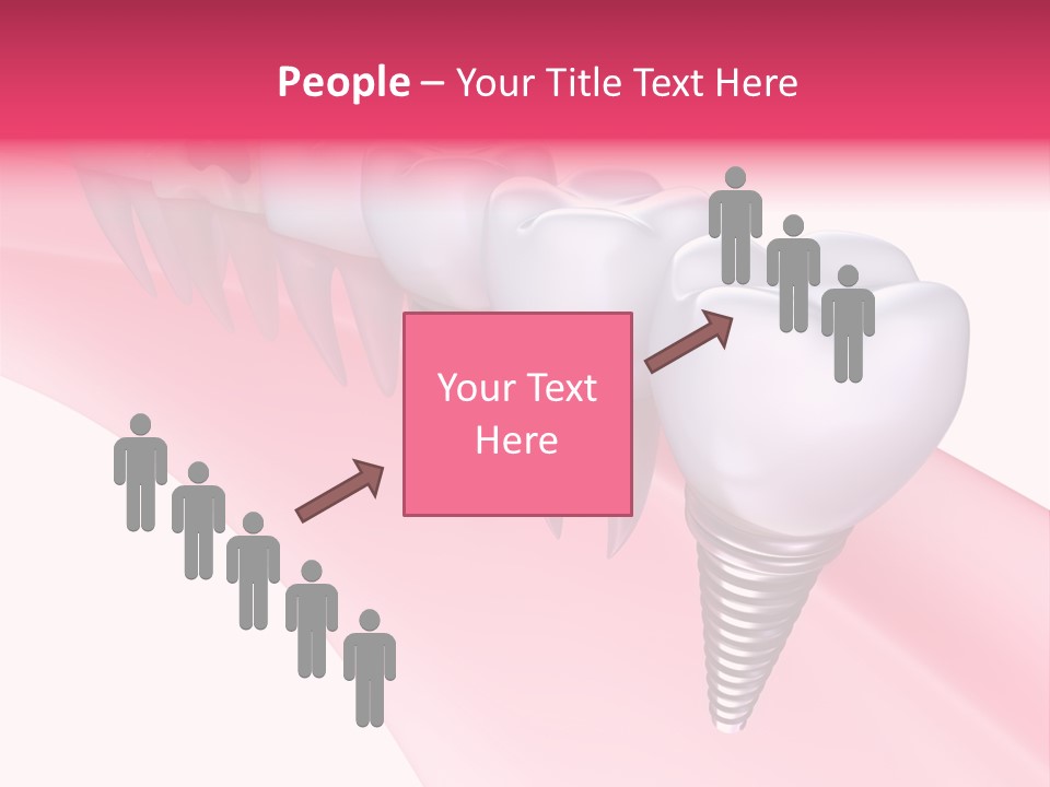 Treatment Prosthesis Isolated PowerPoint Template