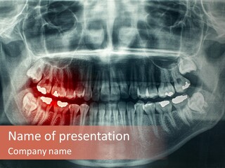 Skull Internal Jaw PowerPoint Template