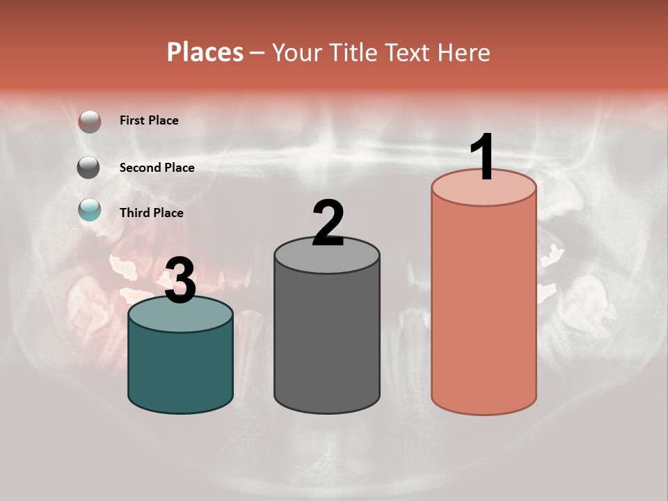 Skull Internal Jaw PowerPoint Template