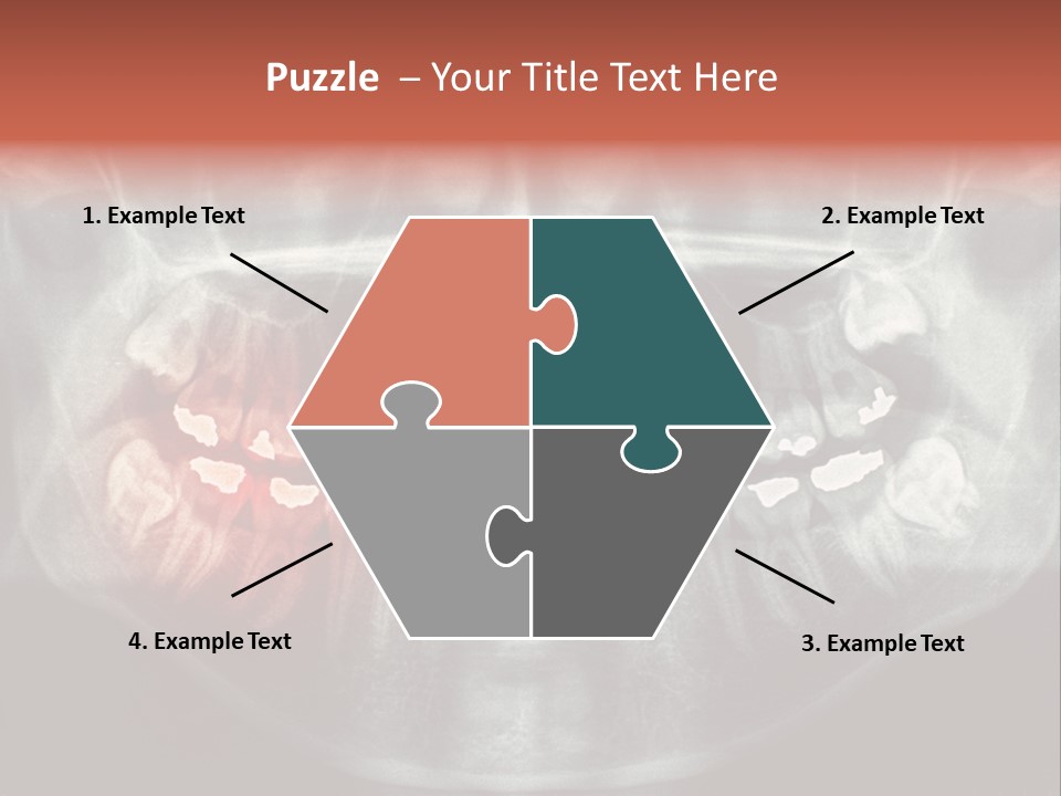 Skull Internal Jaw PowerPoint Template
