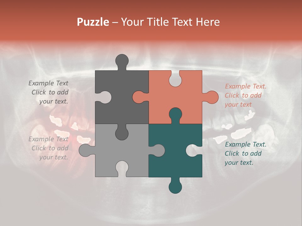 Skull Internal Jaw PowerPoint Template