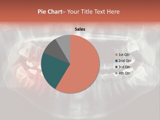 Skull Internal Jaw PowerPoint Template