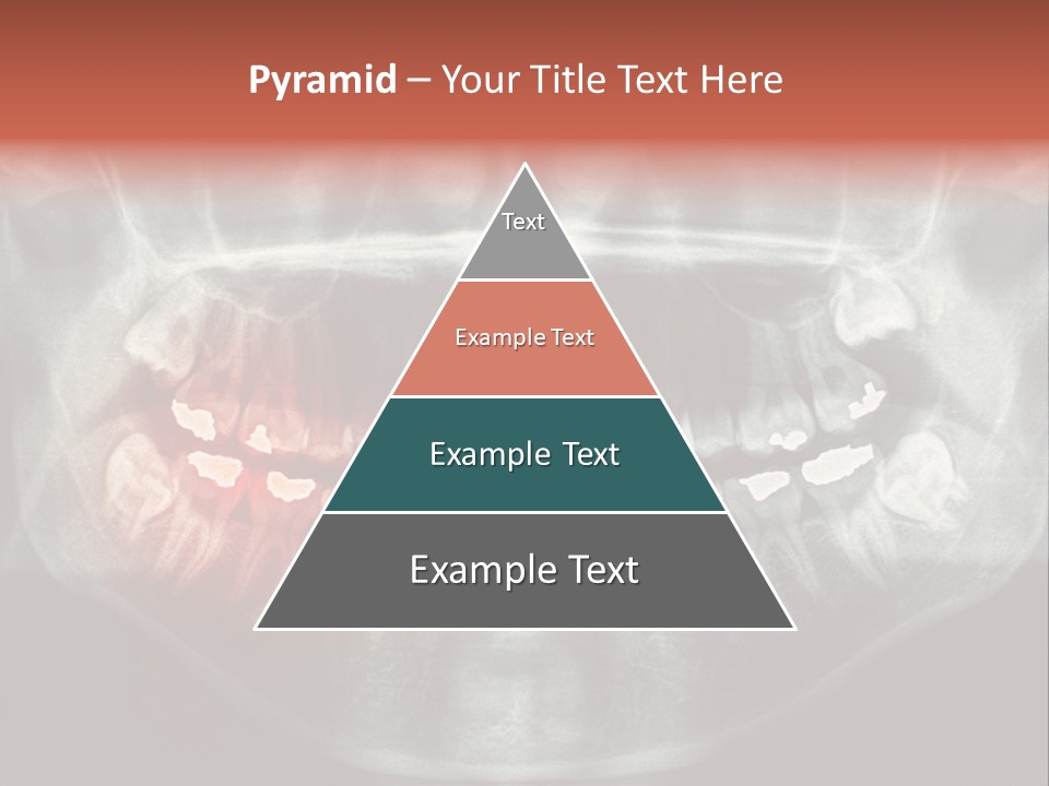 Skull Internal Jaw PowerPoint Template