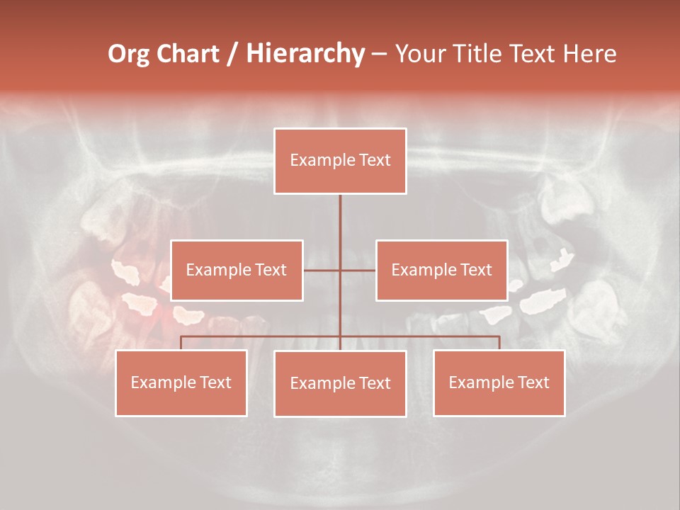 Skull Internal Jaw PowerPoint Template