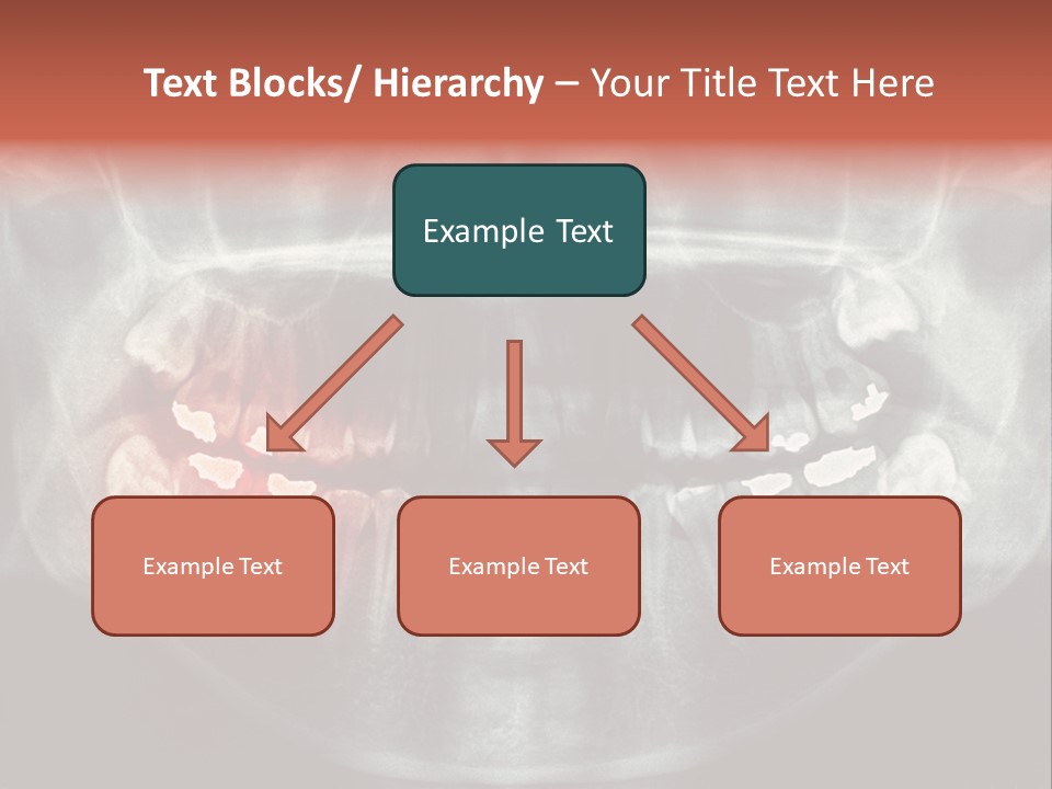 Skull Internal Jaw PowerPoint Template