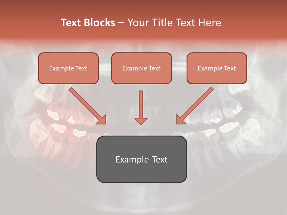 Skull Internal Jaw PowerPoint Template