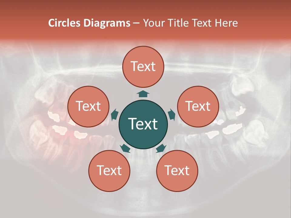 Skull Internal Jaw PowerPoint Template