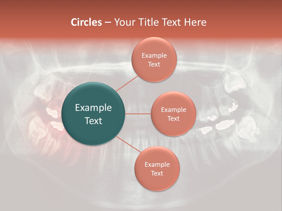Skull Internal Jaw PowerPoint Template