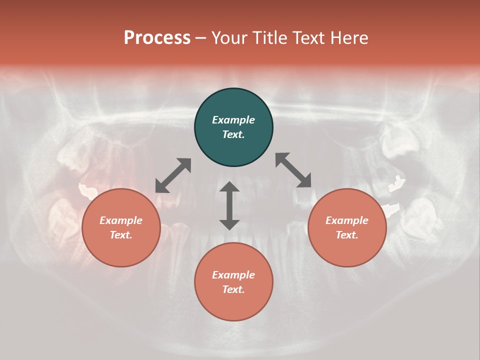 Skull Internal Jaw PowerPoint Template