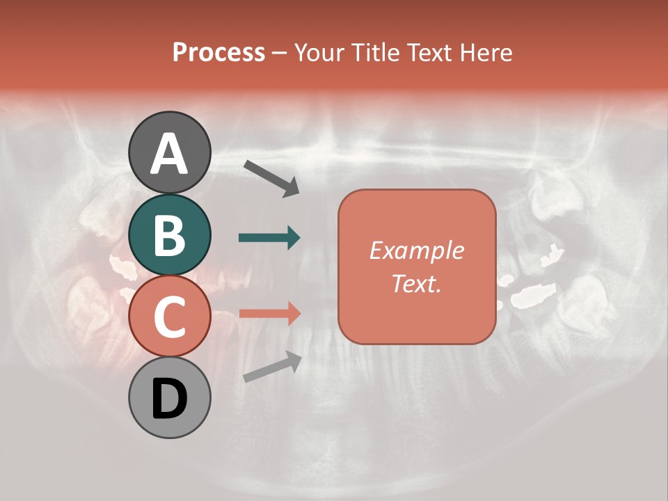 Skull Internal Jaw PowerPoint Template