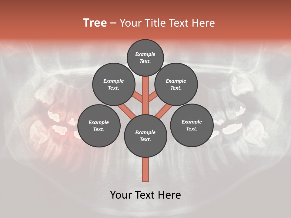 Skull Internal Jaw PowerPoint Template