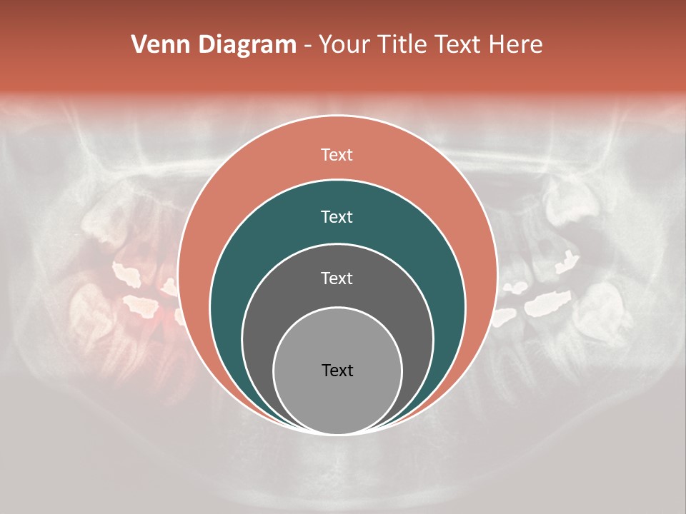 Skull Internal Jaw PowerPoint Template