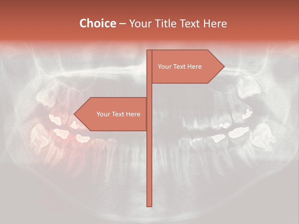 Skull Internal Jaw PowerPoint Template