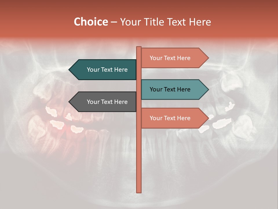 Skull Internal Jaw PowerPoint Template