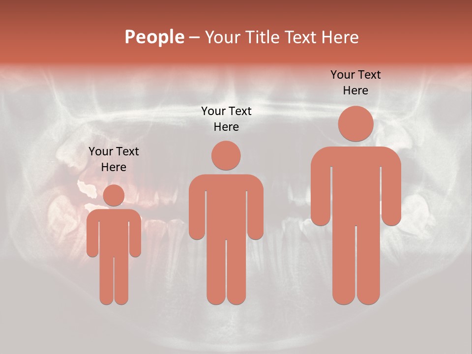 Skull Internal Jaw PowerPoint Template