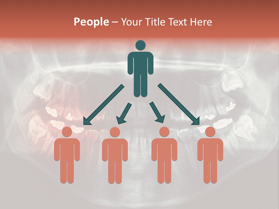 Skull Internal Jaw PowerPoint Template