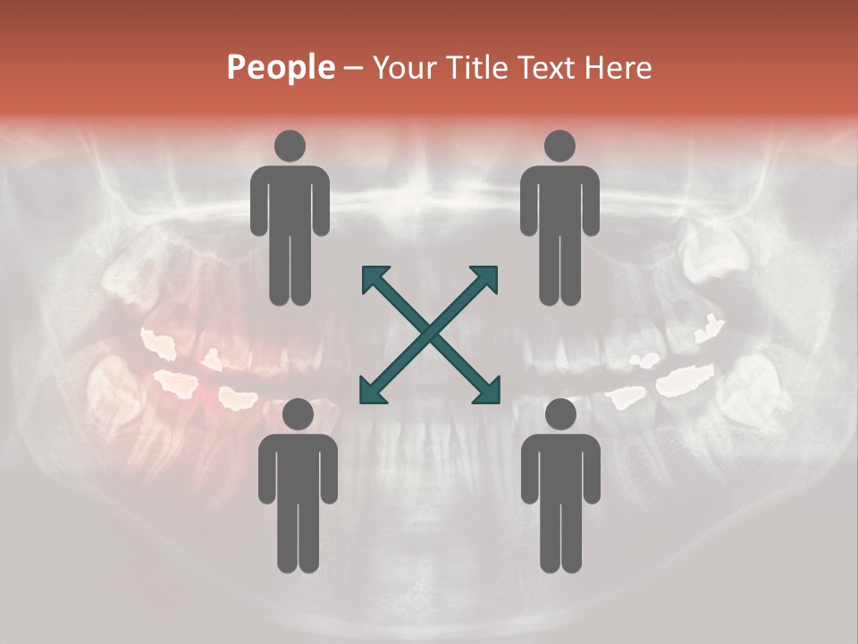 Skull Internal Jaw PowerPoint Template