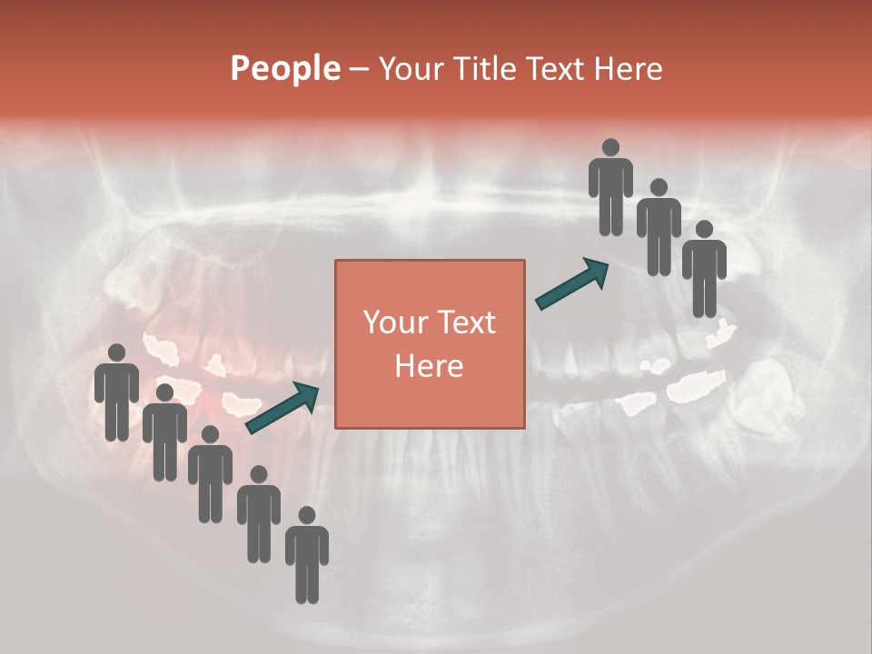 Skull Internal Jaw PowerPoint Template
