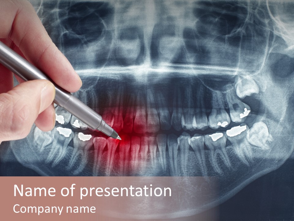 White Toothache Tooth PowerPoint Template