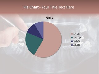 White Toothache Tooth PowerPoint Template