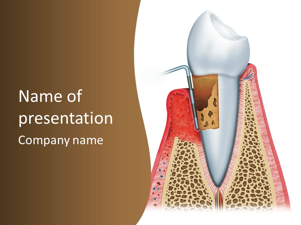 Tartar Porcelain Health PowerPoint Template