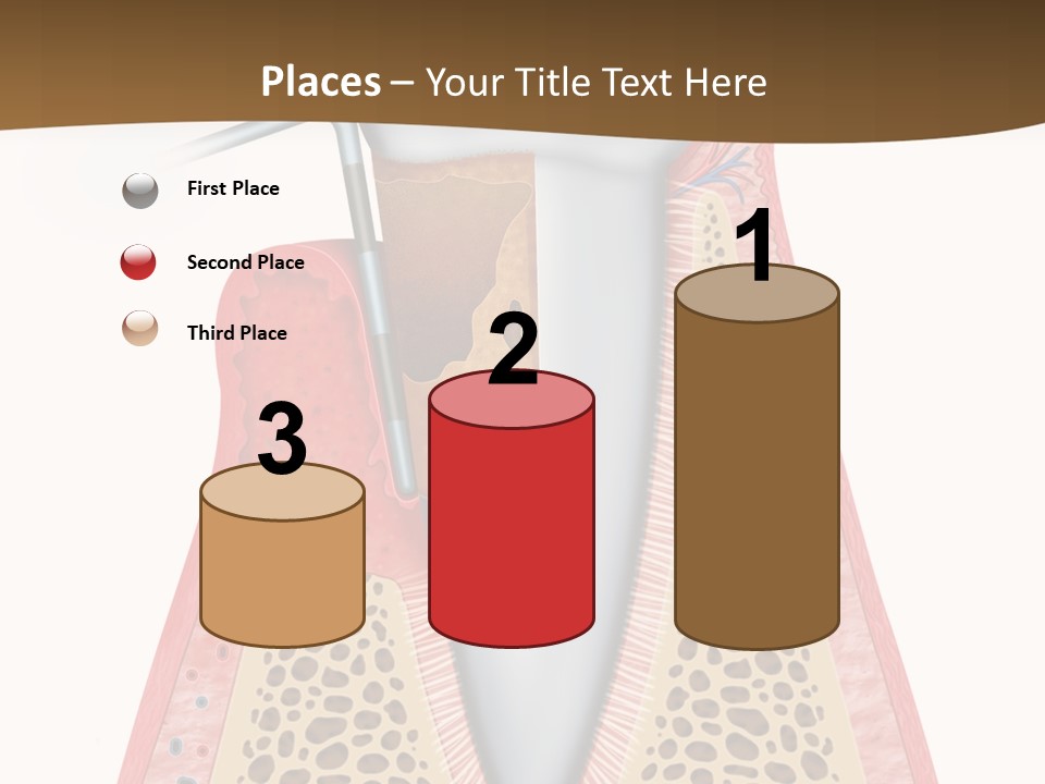 Tartar Porcelain Health PowerPoint Template
