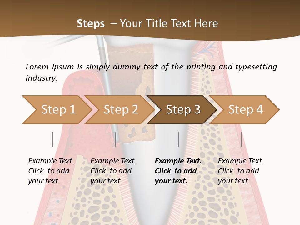 Tartar Porcelain Health PowerPoint Template