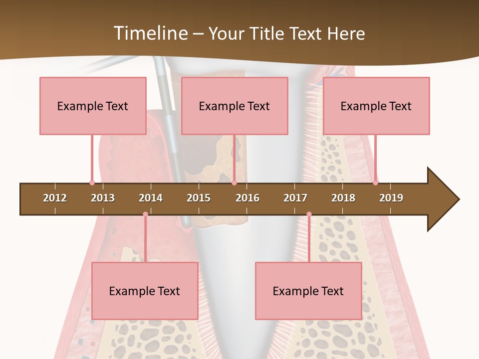 Tartar Porcelain Health PowerPoint Template