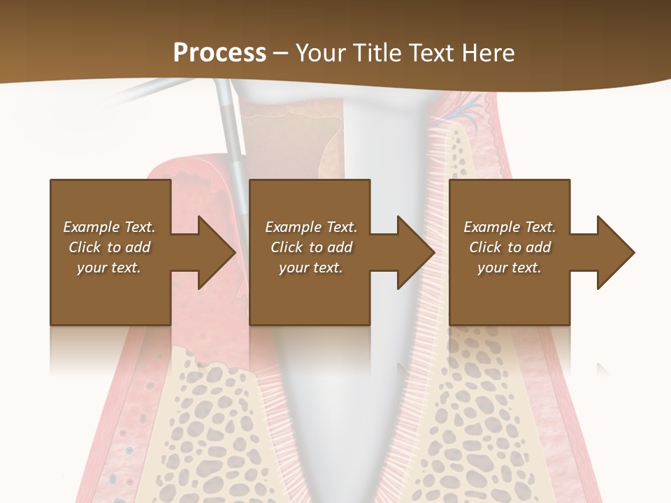 Tartar Porcelain Health PowerPoint Template
