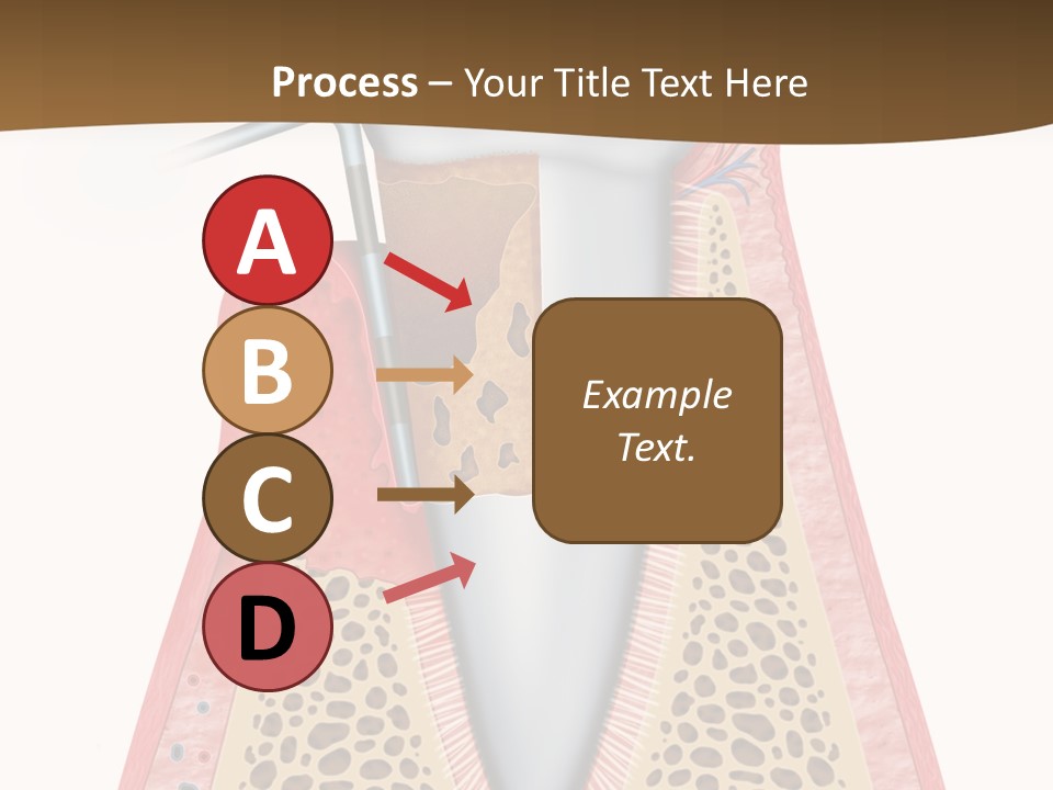 Tartar Porcelain Health PowerPoint Template