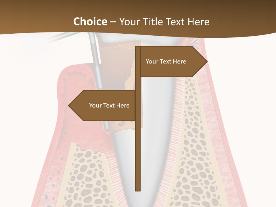 Tartar Porcelain Health PowerPoint Template