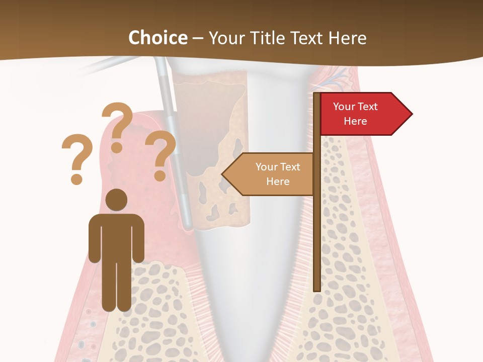 Tartar Porcelain Health PowerPoint Template