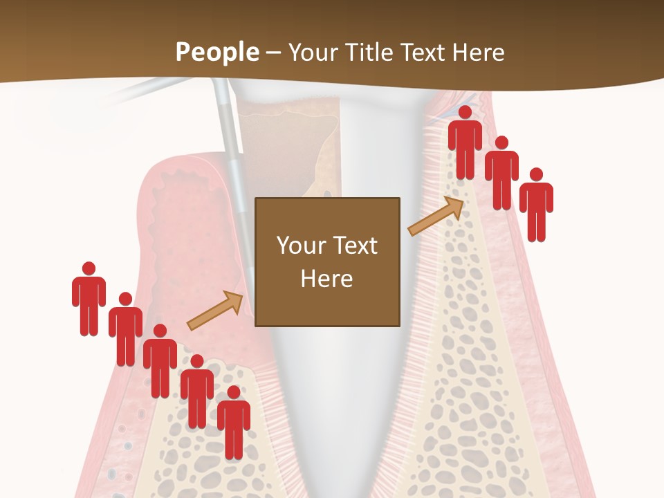 Tartar Porcelain Health PowerPoint Template