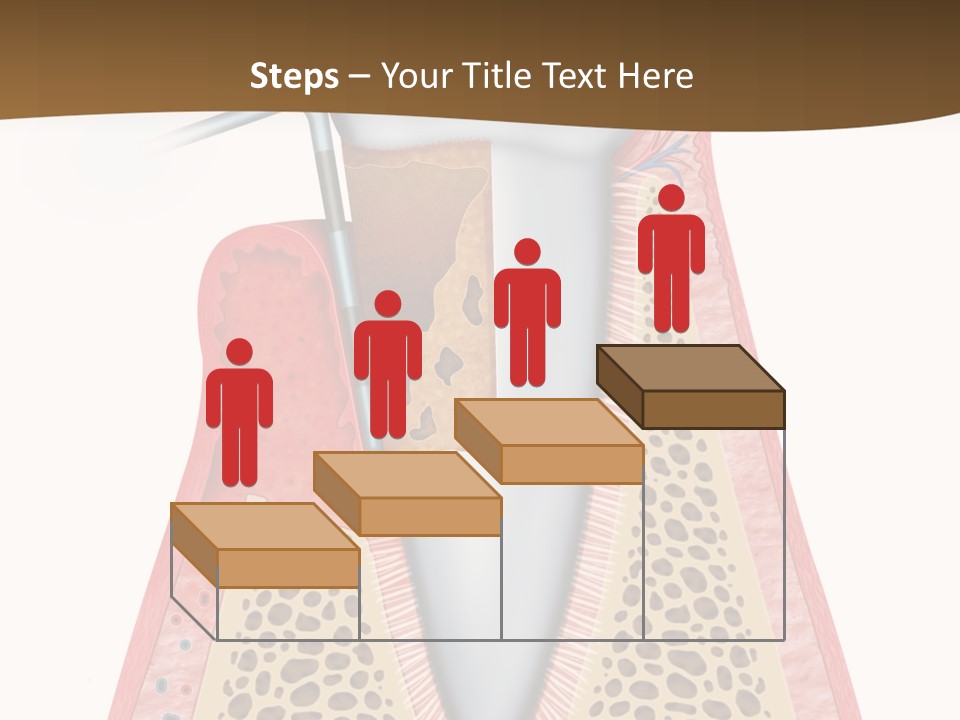 Tartar Porcelain Health PowerPoint Template