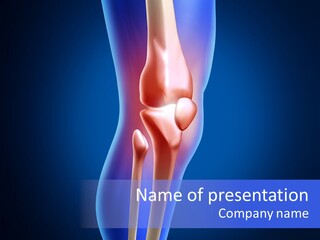 Osteoporosis Medicine Arthritis PowerPoint Template