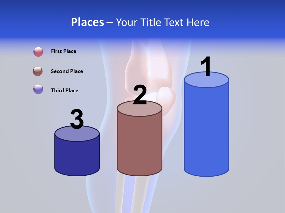 Osteoporosis Medicine Arthritis PowerPoint Template
