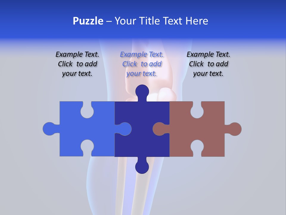 Osteoporosis Medicine Arthritis PowerPoint Template
