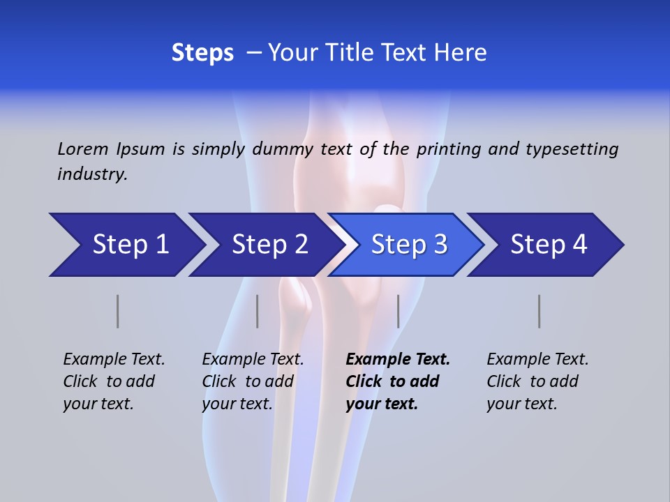 Osteoporosis Medicine Arthritis PowerPoint Template