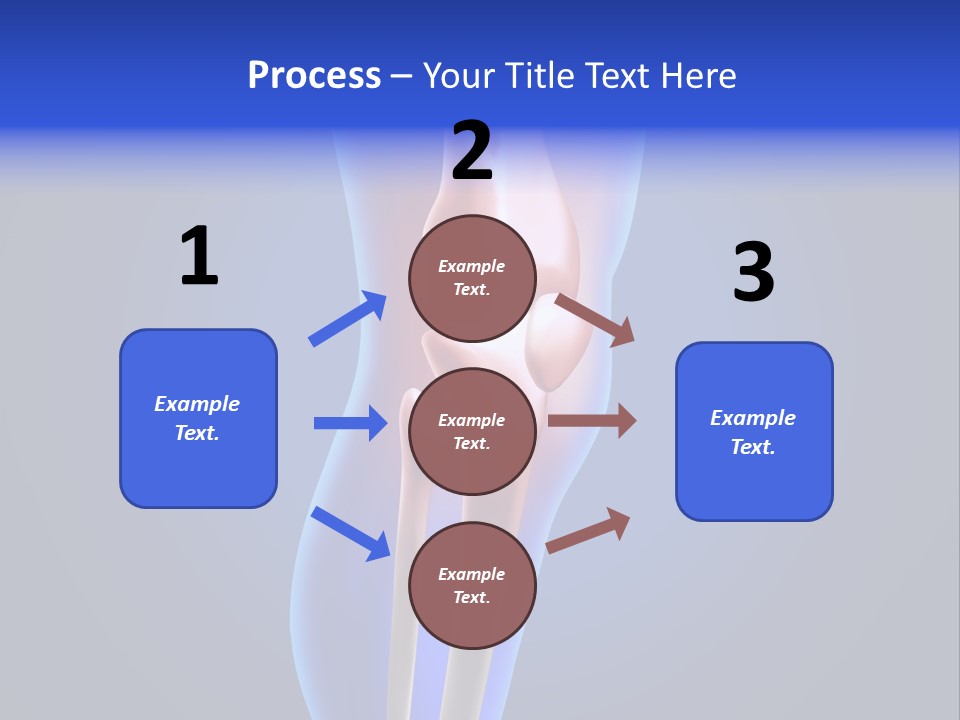 Osteoporosis Medicine Arthritis PowerPoint Template