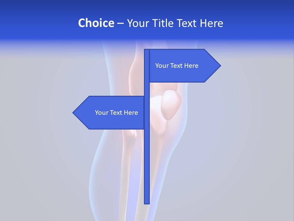 Osteoporosis Medicine Arthritis PowerPoint Template