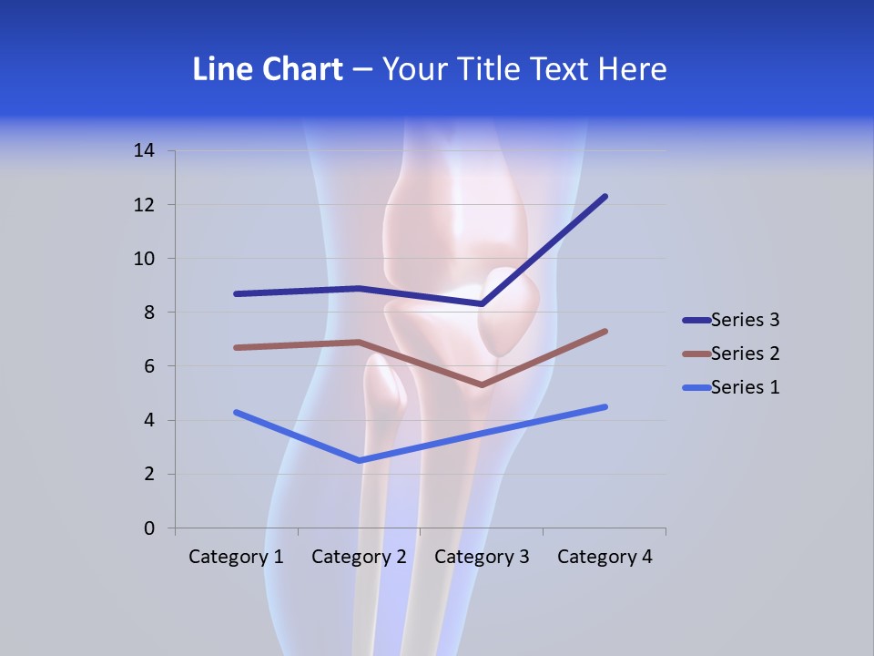Osteoporosis Medicine Arthritis PowerPoint Template